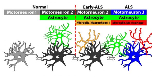 Different types of neurons and associated cells are found in spinal tissue from patients who died of ALS. Image: Fei Song.